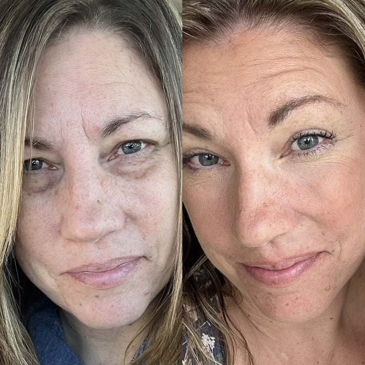The eye bag problem i struggle to fix!